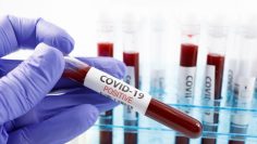 991-ratio-koronavirus-proba-pcr-test