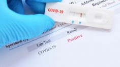 991-ratio-koronavirus-test