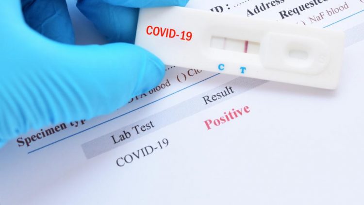 991-ratio-koronavirus-test